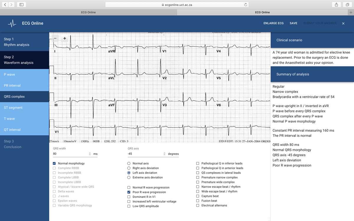 apex innovations ecg test answers