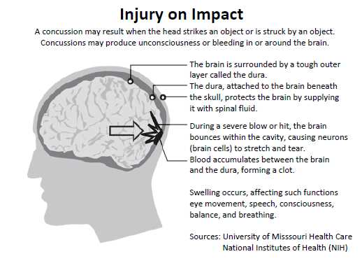 brainbook concussion test answers