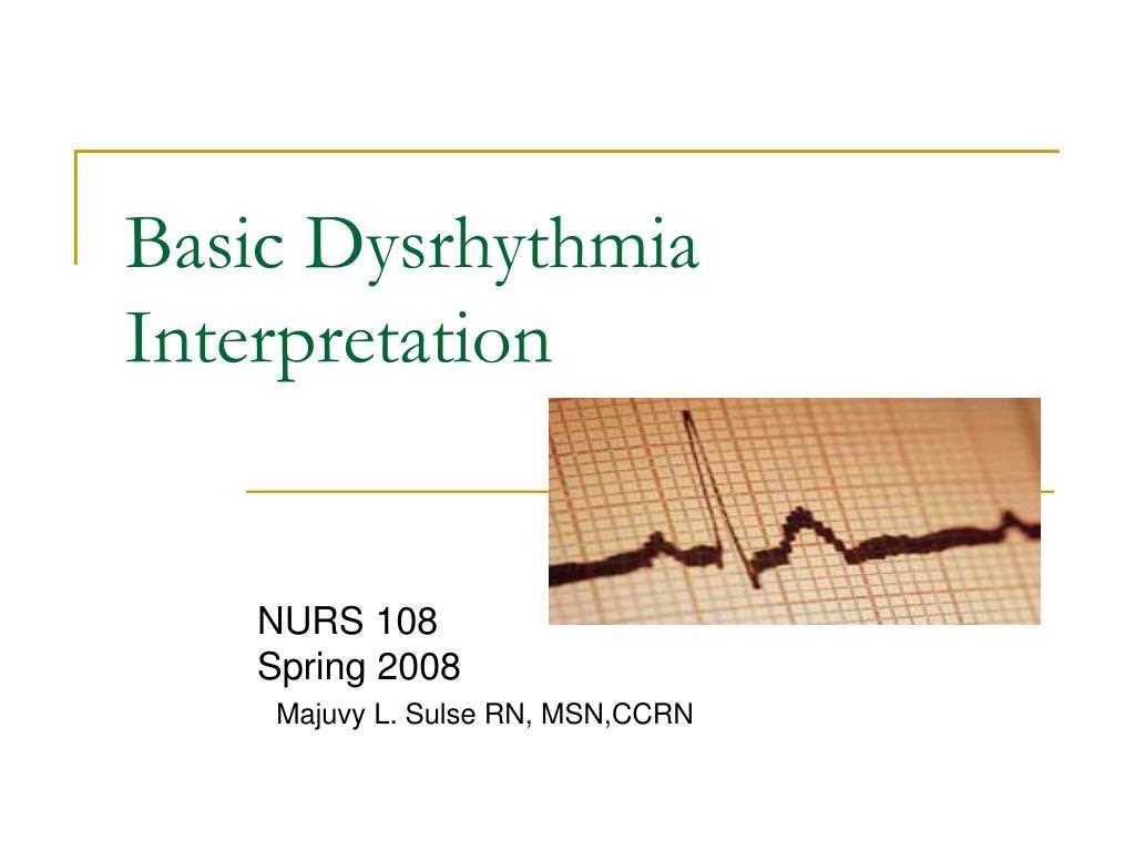 dysrhythmia test answers