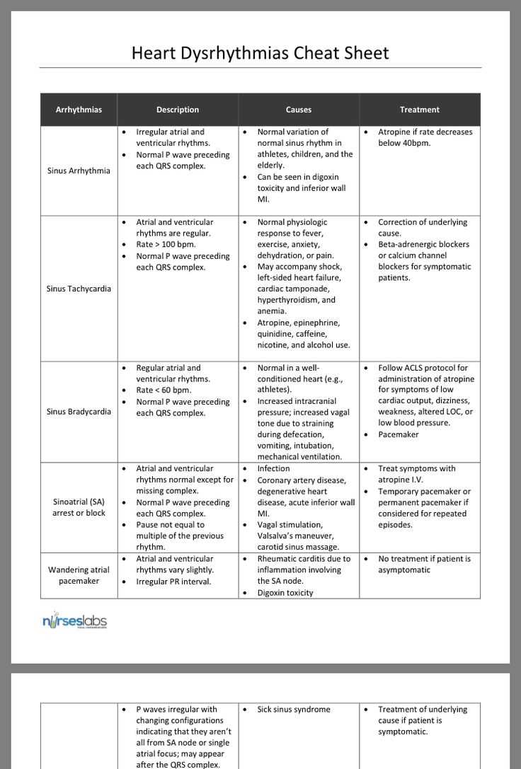 dysrhythmia test answers
