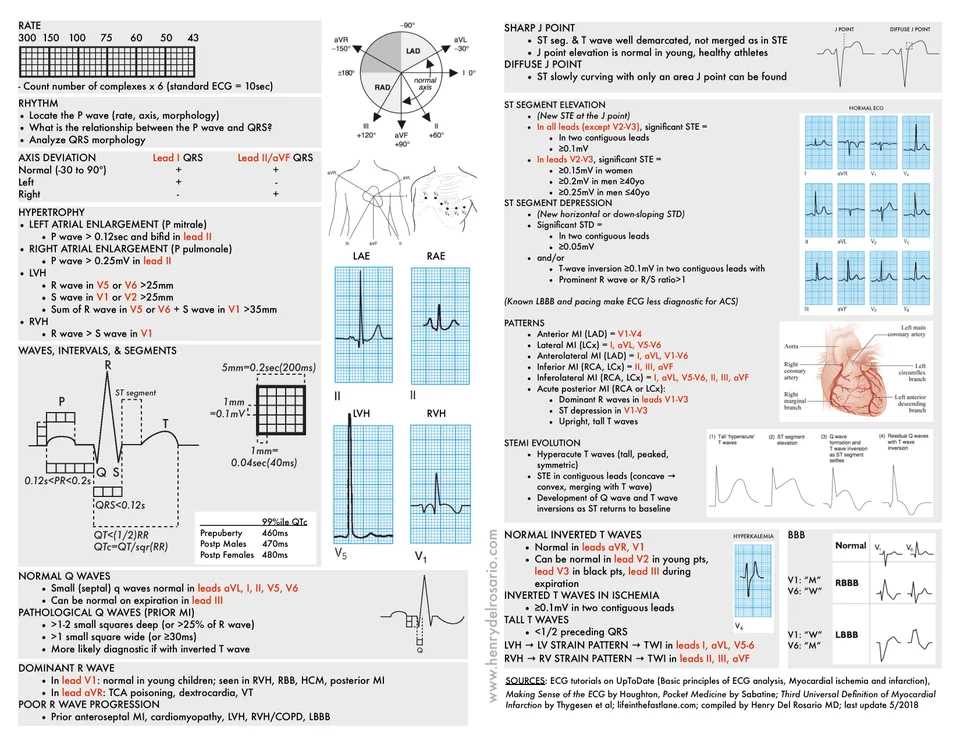 ekg interpretation cheat sheet relias dysrhythmia basic a test answers