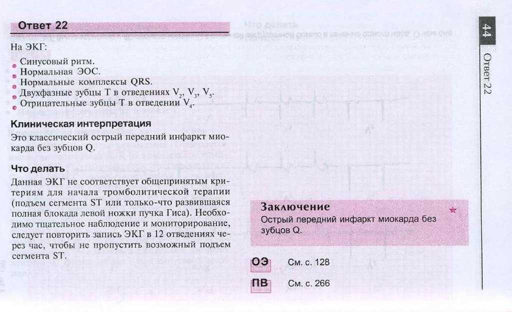 ekg test answers