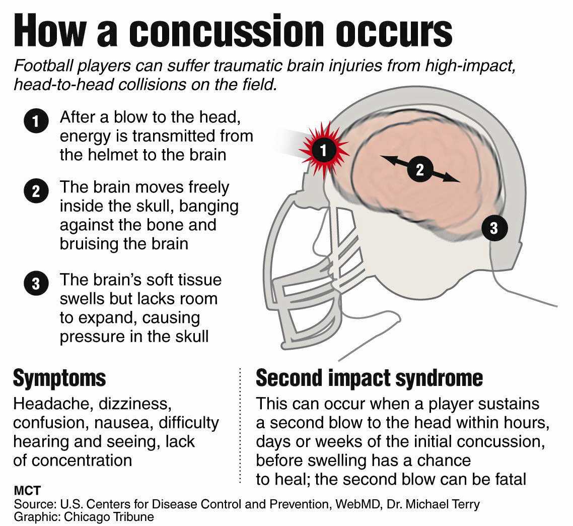 heads up concussion test answers