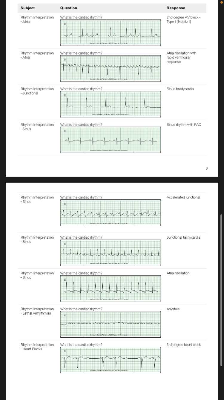 ecg test strips with answers