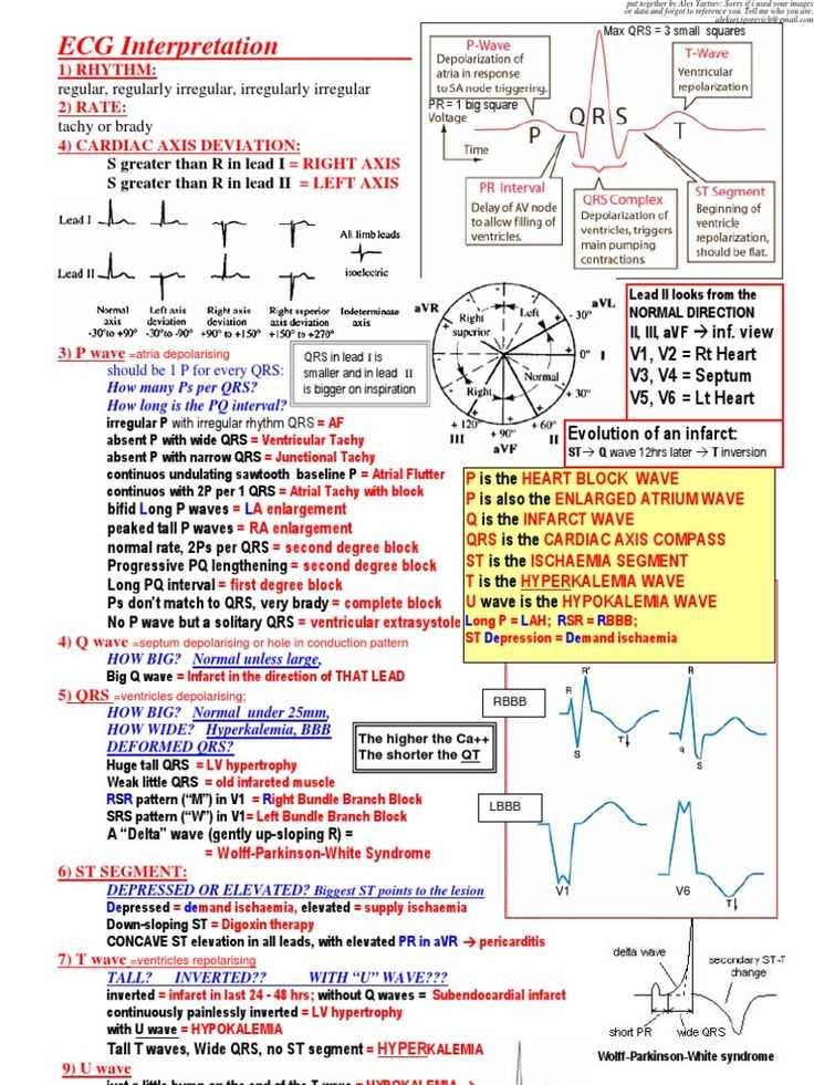 ekg interpretation cheat sheet relias dysrhythmia basic a test answers
