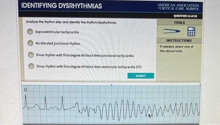 rn com dysrhythmia exam answers
