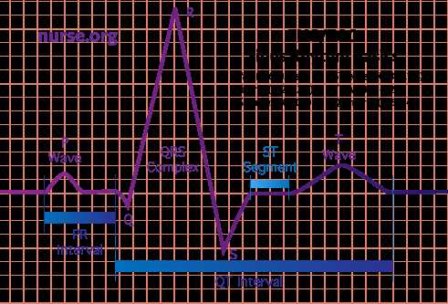 dh basic ekg interpretation test part 1 answer key